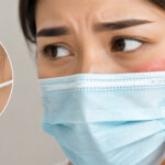 Irritation from face masks?