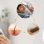 Facing hair loss after fever? Know the reasons from hair transplant expert, Dr. Kriti Jain