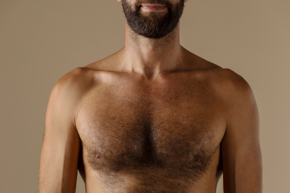 A Vital Guide To Body Hair Transplant