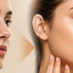 Is Scar Correction Possible?