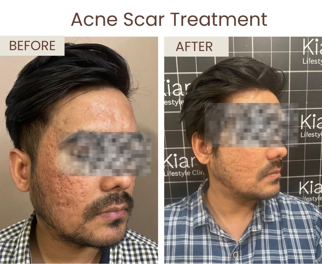 Before after website size (1)