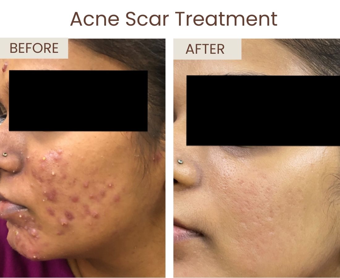 Before after website size (2)