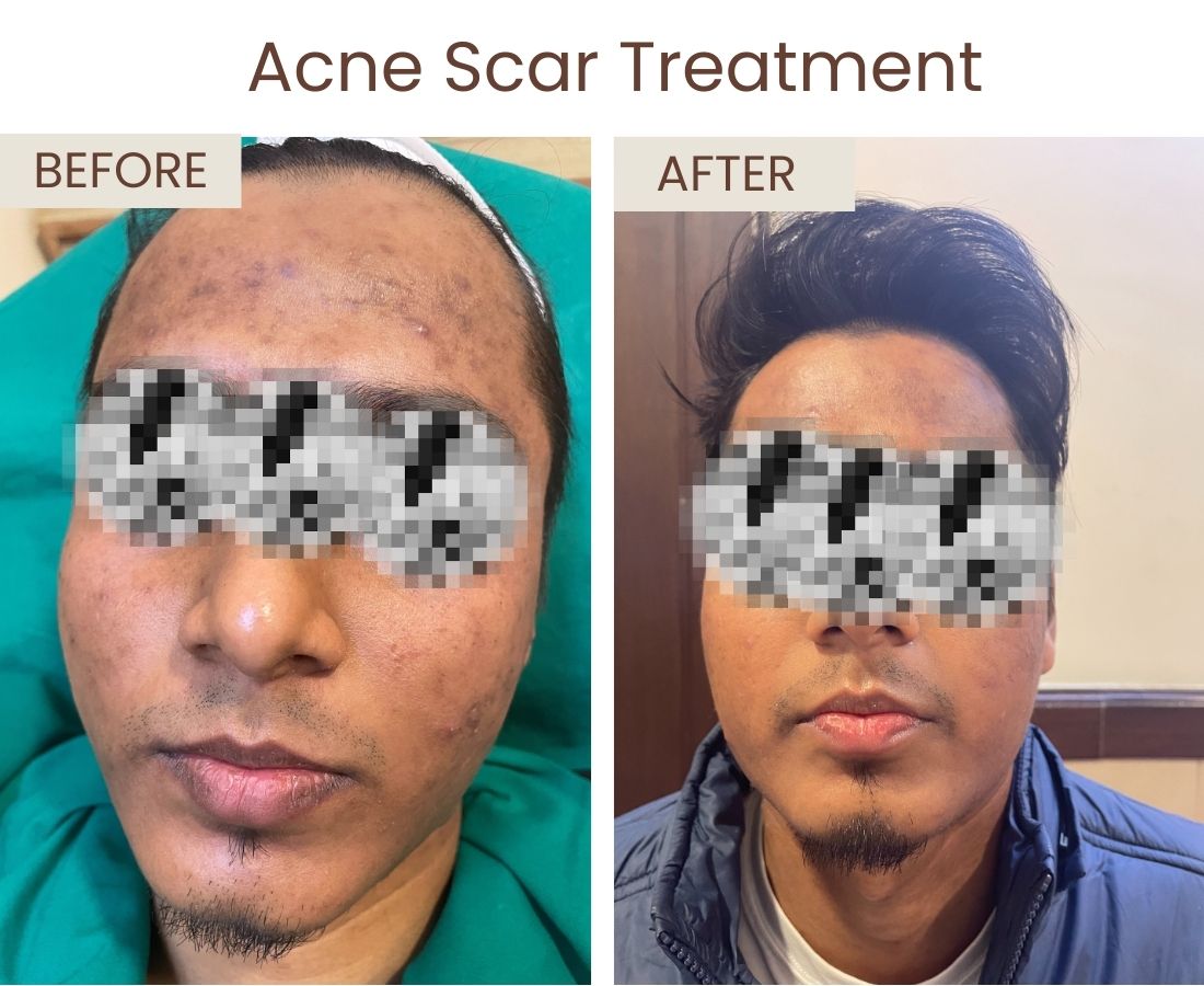 Before after website size (3)
