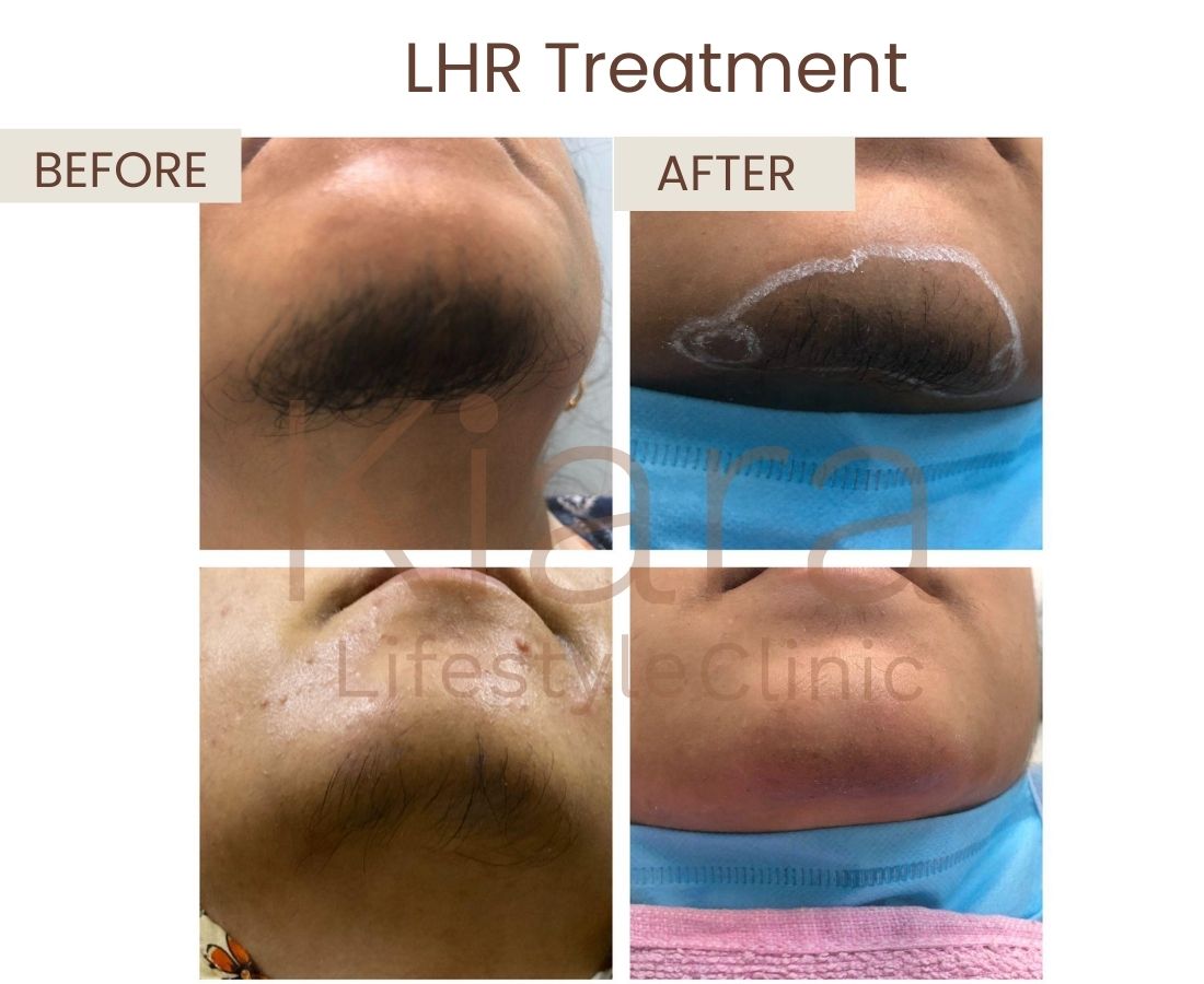 Before after website size (4)