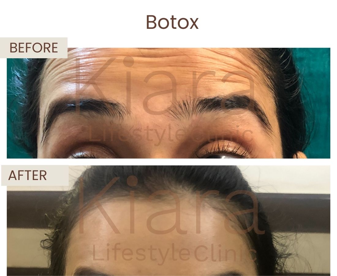 Before after website size (5)