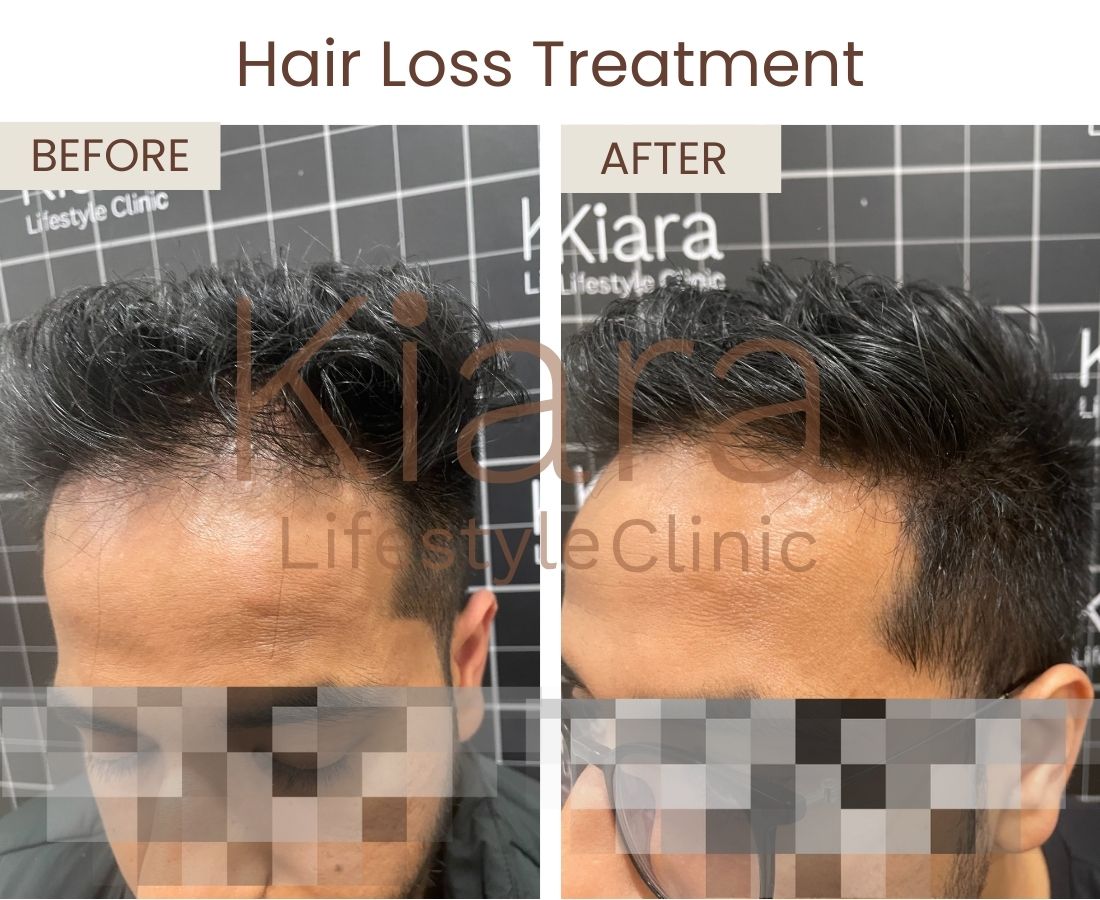 Before after website size