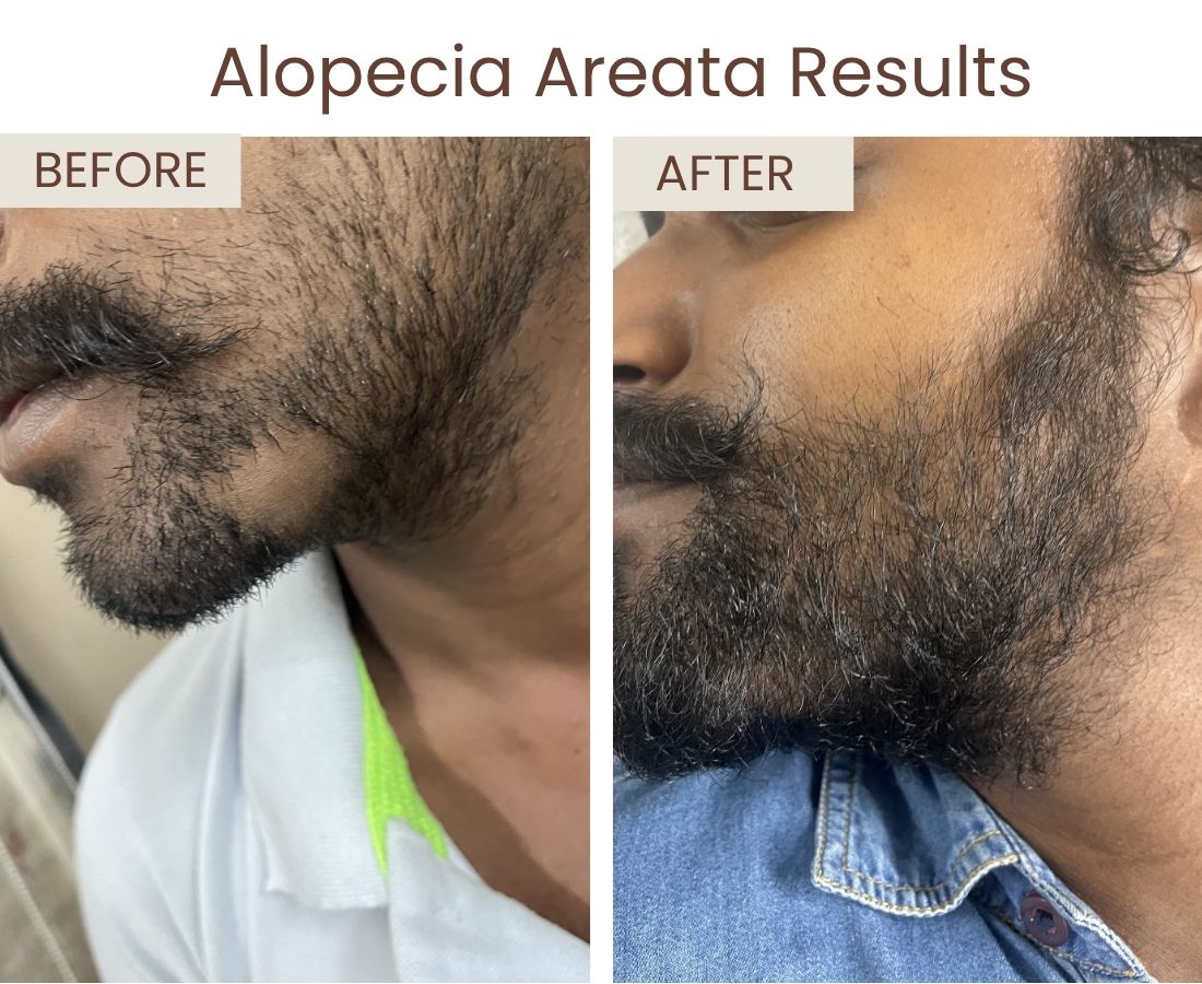 Before after website size (11)