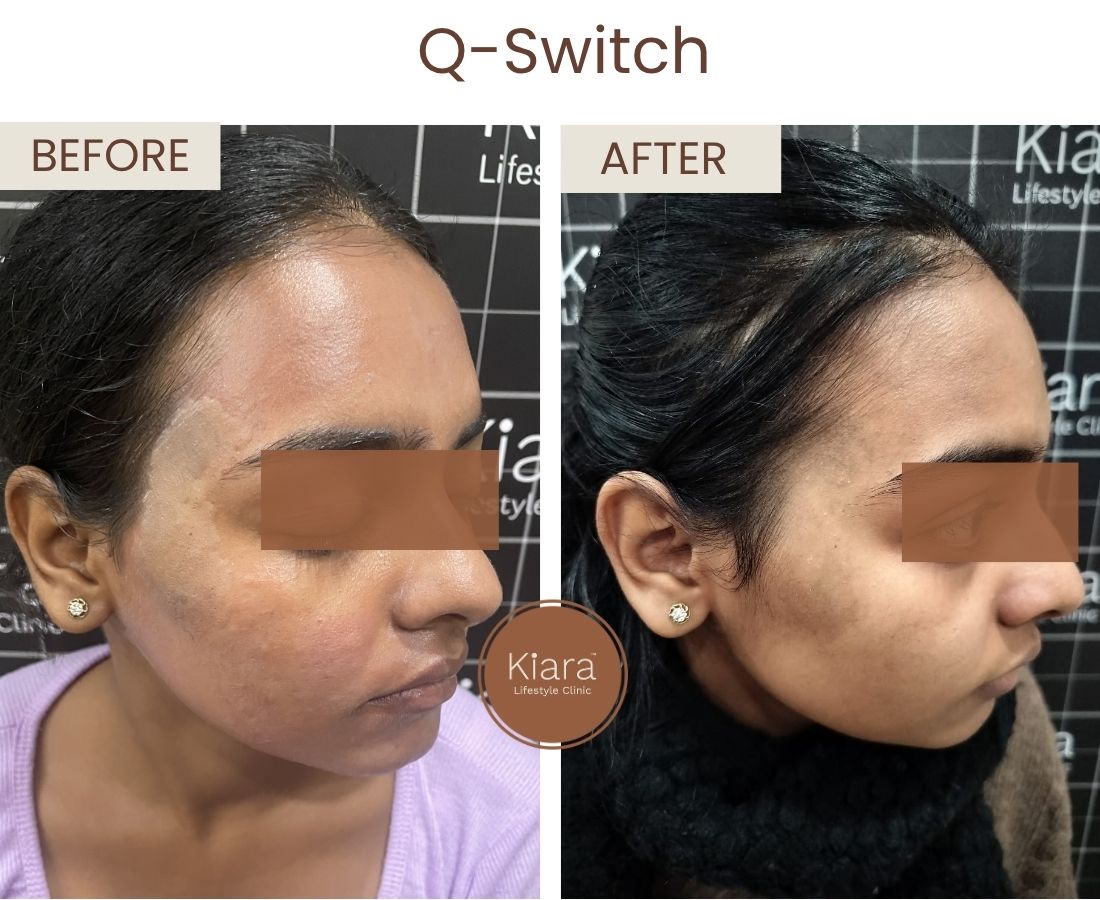 Before after website size (12)