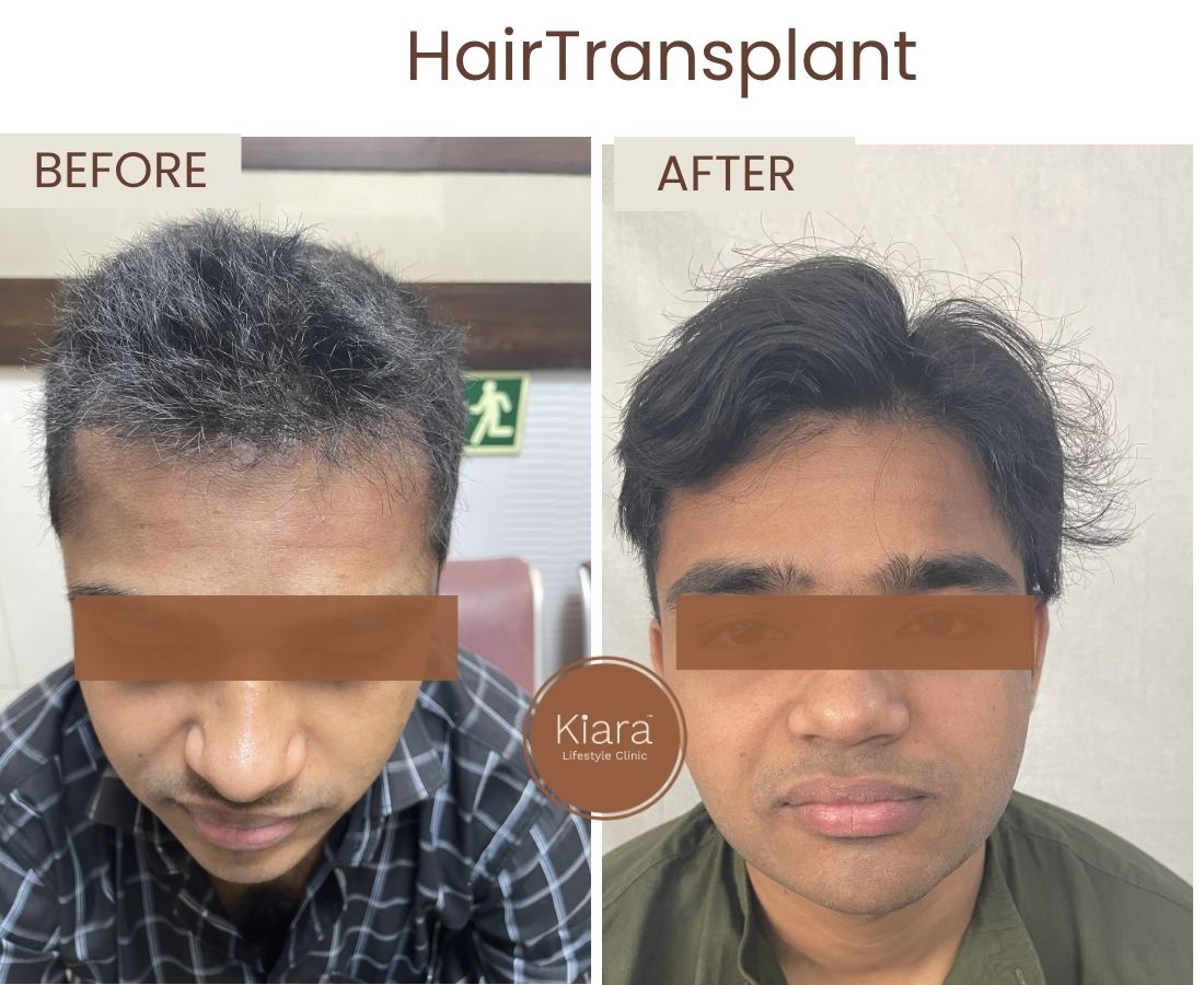 Before after website size (13)