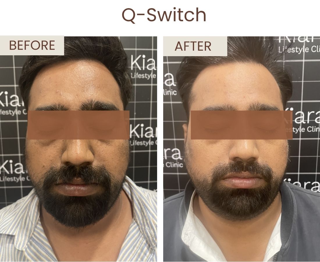 Before after website size (2)