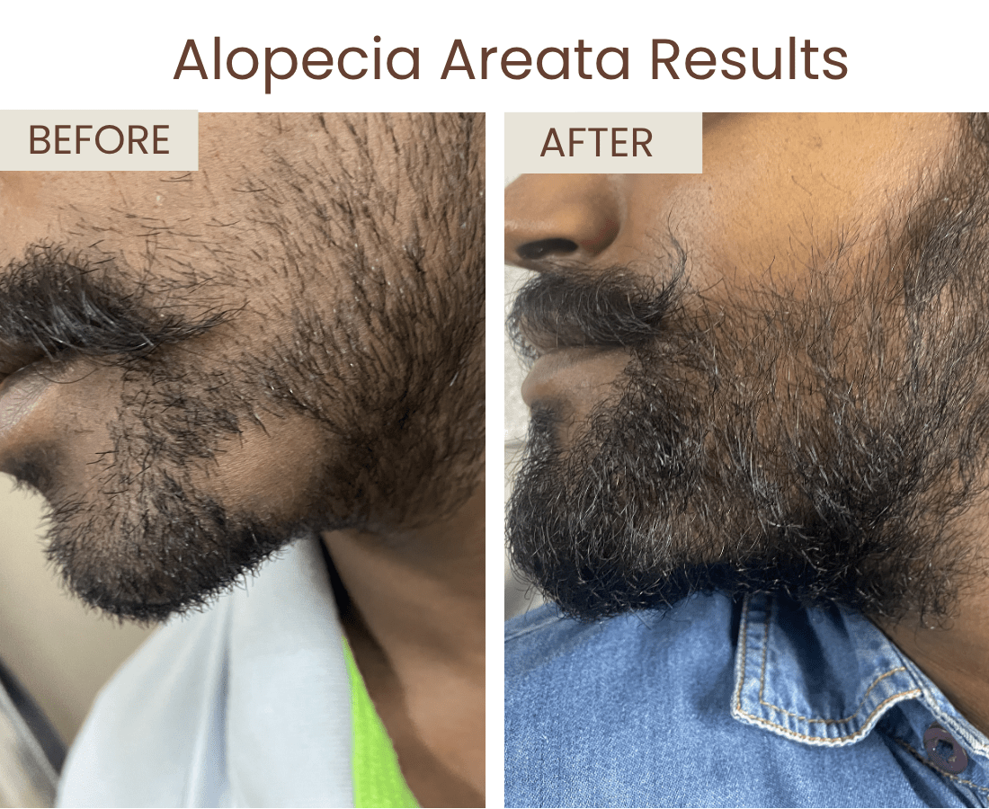 Before after website size (2)