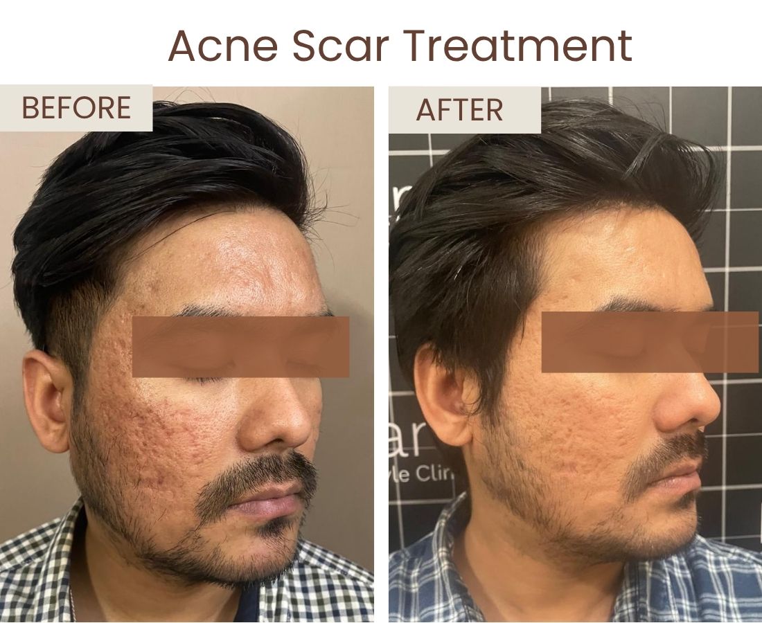 Before after website size (3)