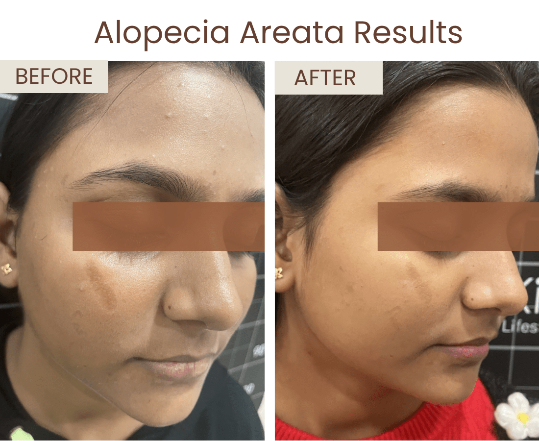 Before after website size (3)