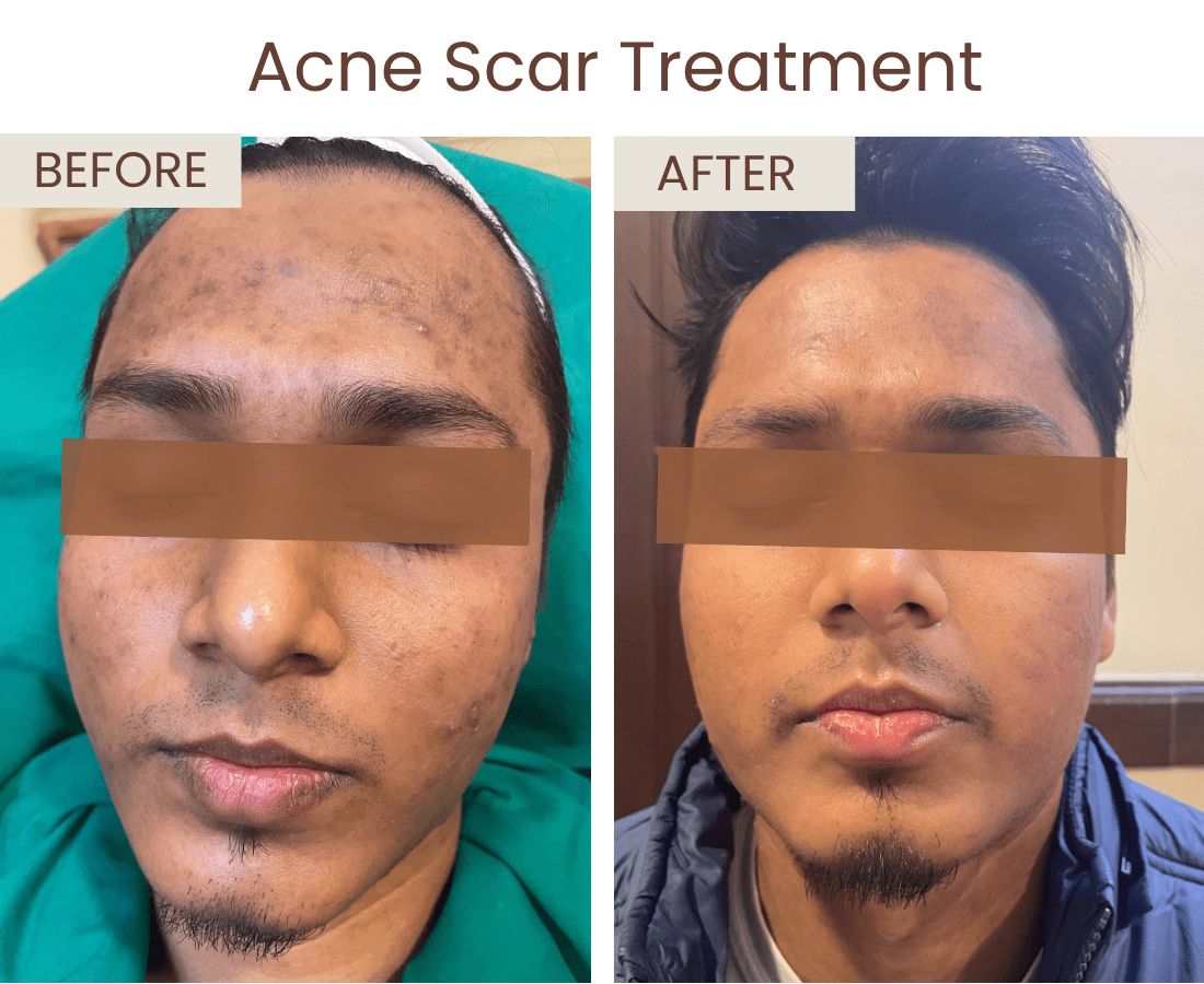 Before after website size (4)