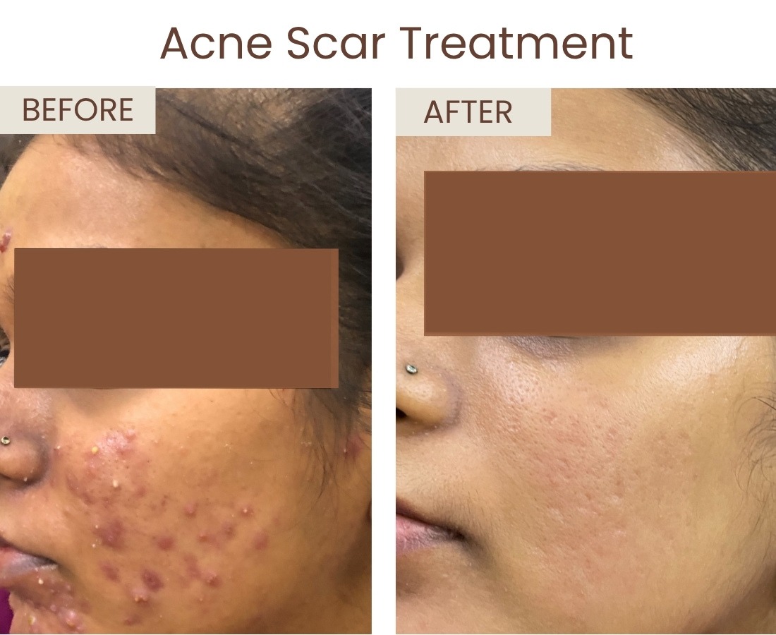 Before after website size (5)