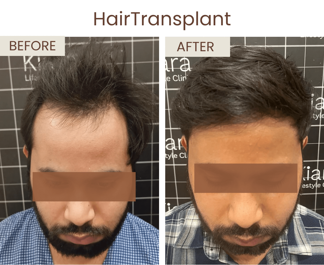 Before after website size (5)