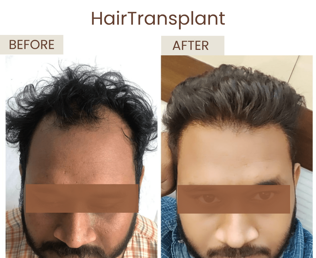 Before after website size (6)