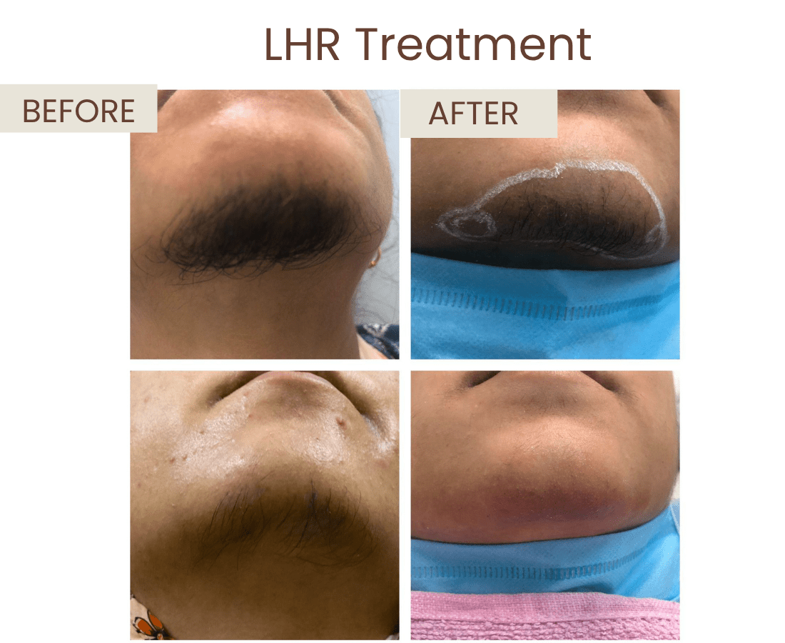 Before after website size (7)