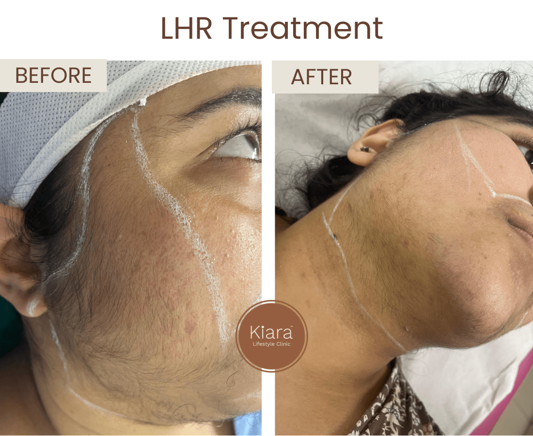 Before after website size (1)