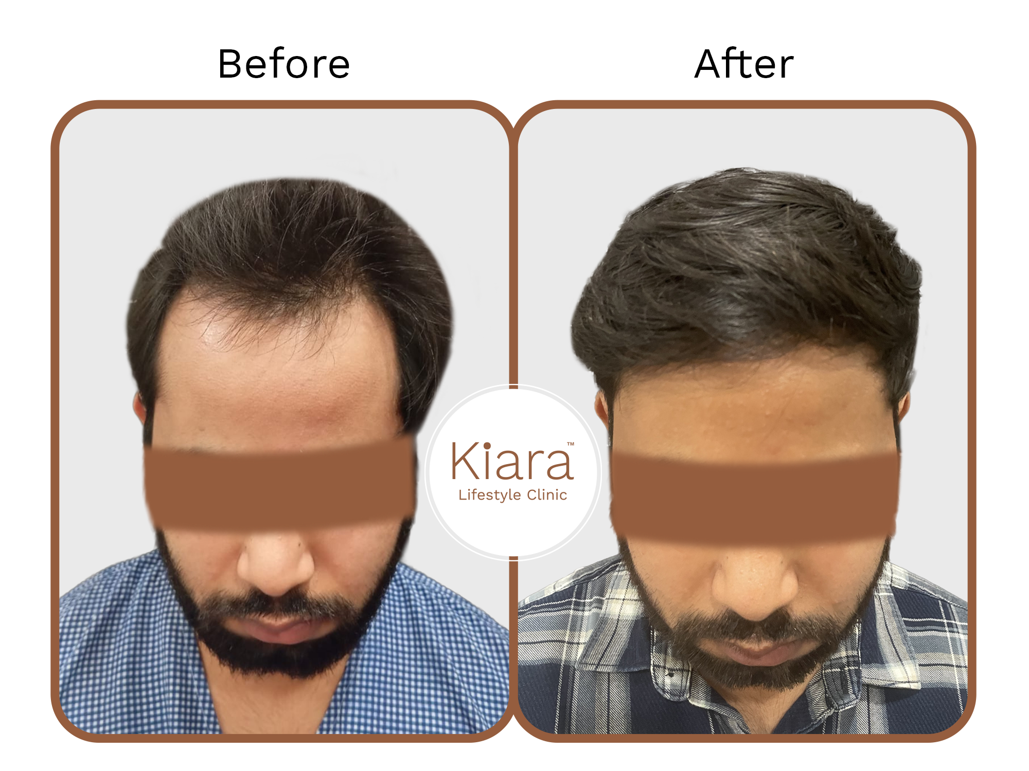 1st Before & After Hair