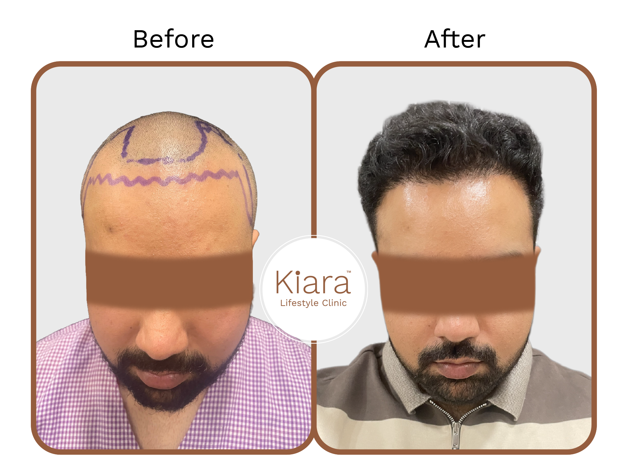 2nd Before & After Hair