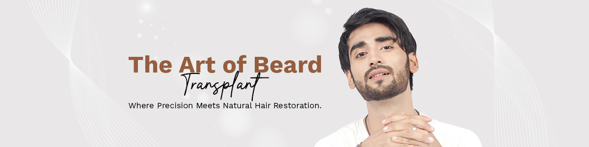 beard transplant in Delhi